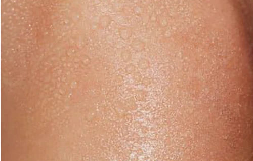 Your Lotion Sweats Off Your Skin in the Heat