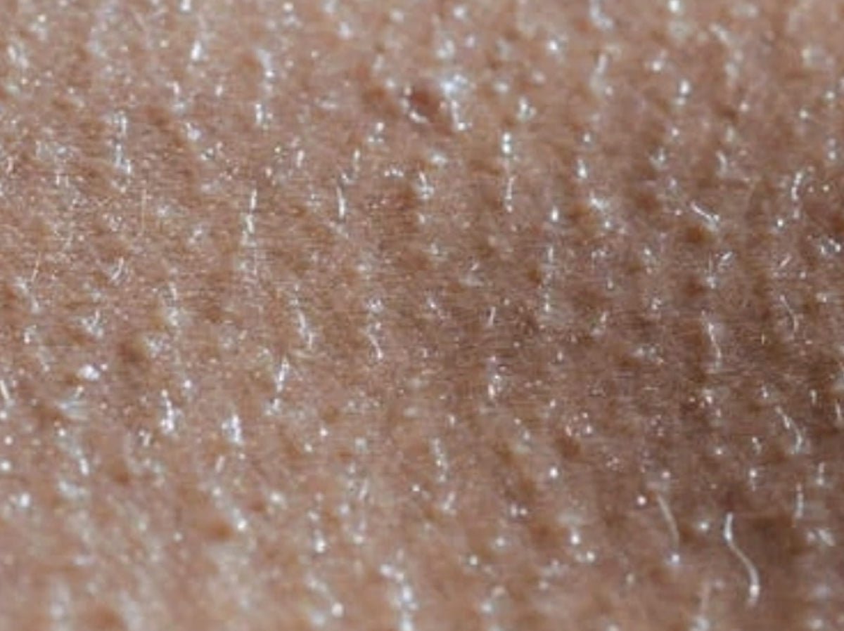 Rough, bumpy skin